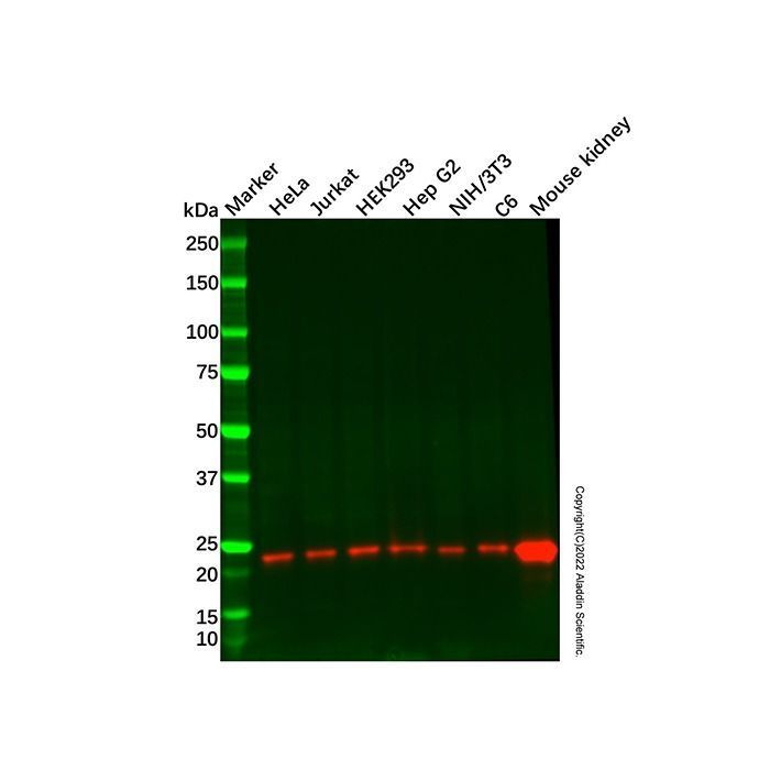 Recombinant NDUFB9 Antibody -    by Aladdin Scientific