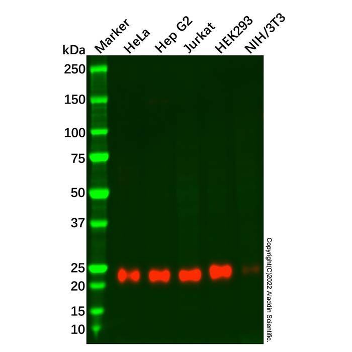 Recombinant NDUFS8 Antibody -    by Aladdin Scientific