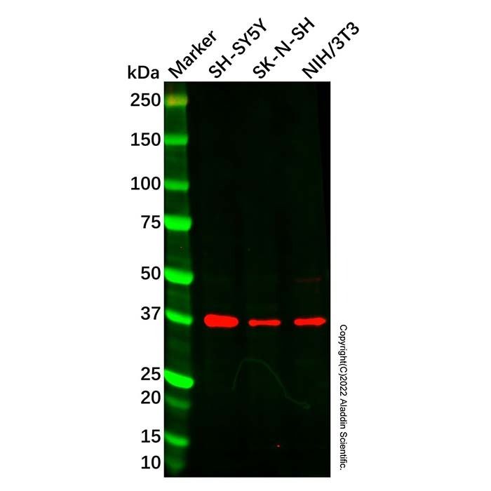 NECL-1 Antibody -    by Aladdin Scientific