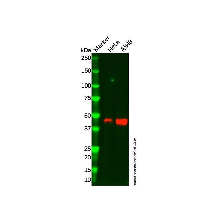 Recombinant NEK2 Antibody -    by Aladdin Scientific