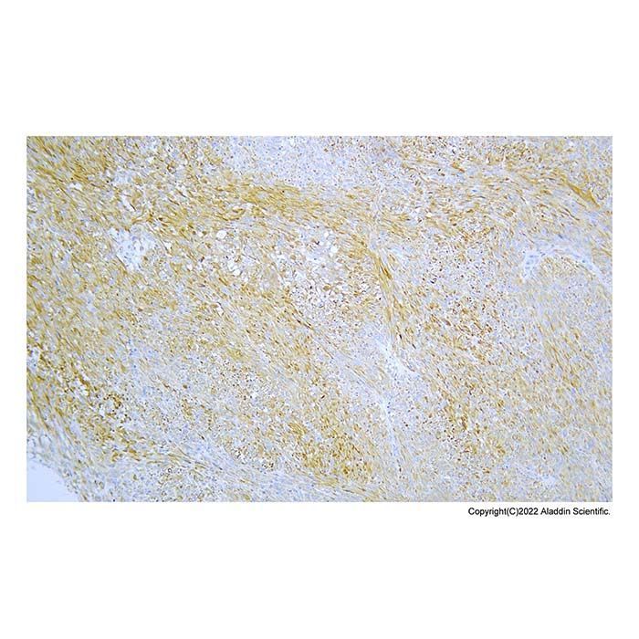Recombinant Nestin Antibody -    by Aladdin Scientific