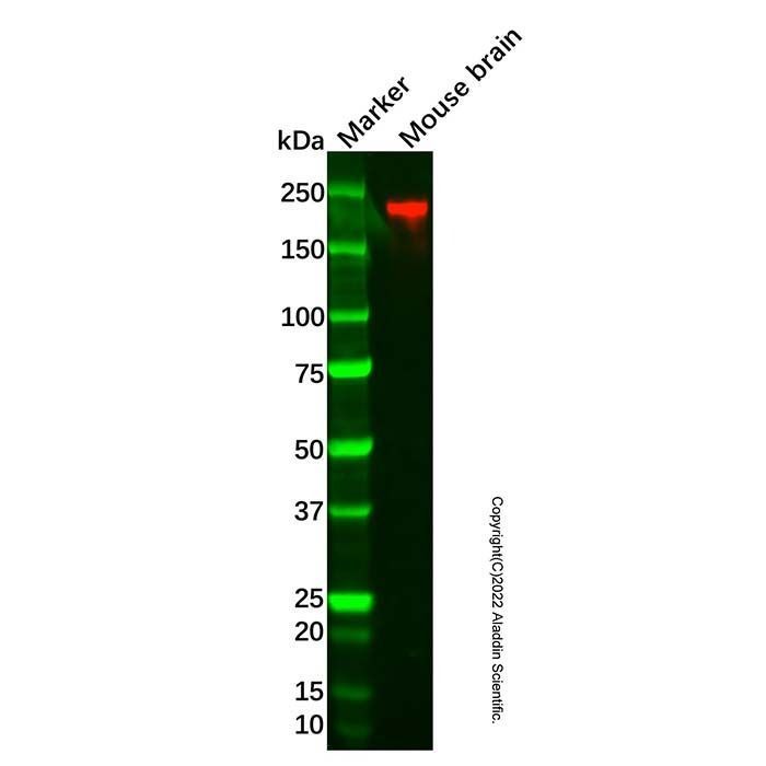 Recombinant Neurofilament heavy polypeptide Antibody -    by Aladdin Scientific