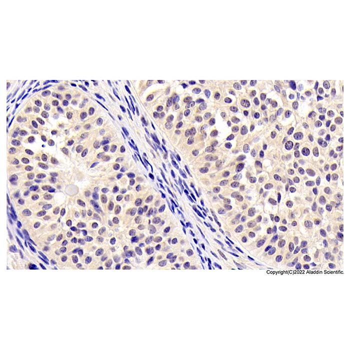 Neurogranin Mouse mAb -    by Aladdin Scientific