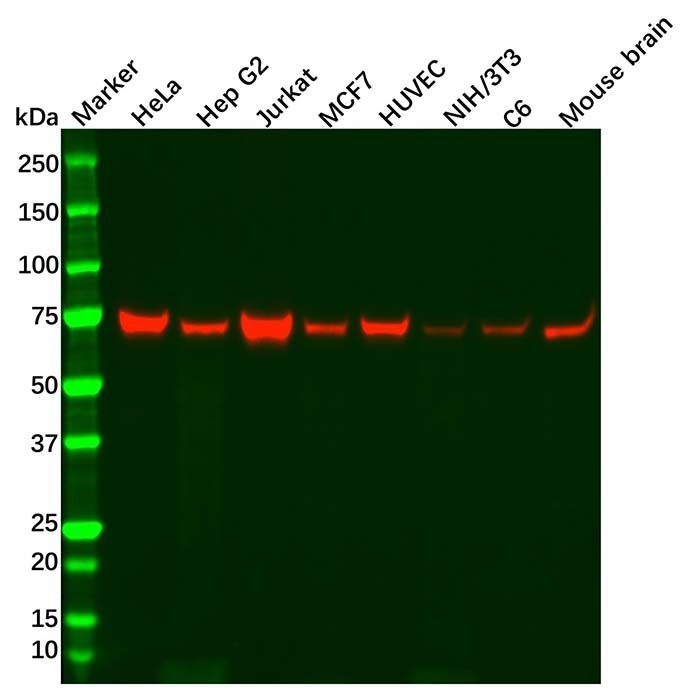 Recombinant NF2/Merlin Antibody -    by Aladdin Scientific