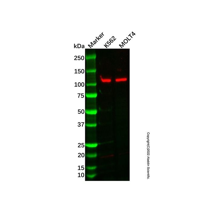Recombinant NFAT2 Antibody -    by Aladdin Scientific