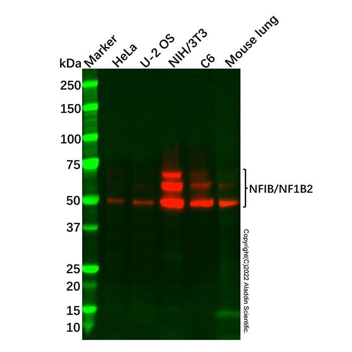 Recombinant NFIB/NF1B2 Antibody -    by Aladdin Scientific