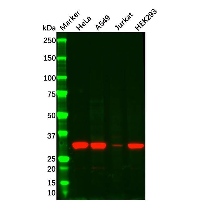 NGF Mouse mAb -    by Aladdin Scientific
