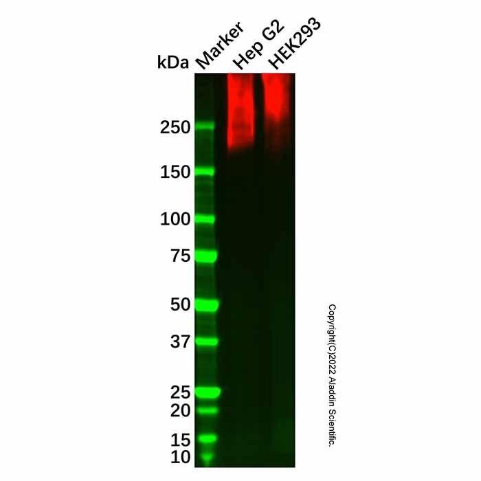 Recombinant Niemann Pick C1 Antibody -    by Aladdin Scientific