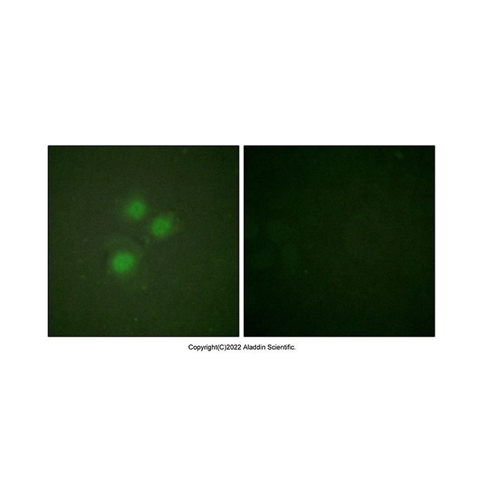 NIFK Antibody -    by Aladdin Scientific