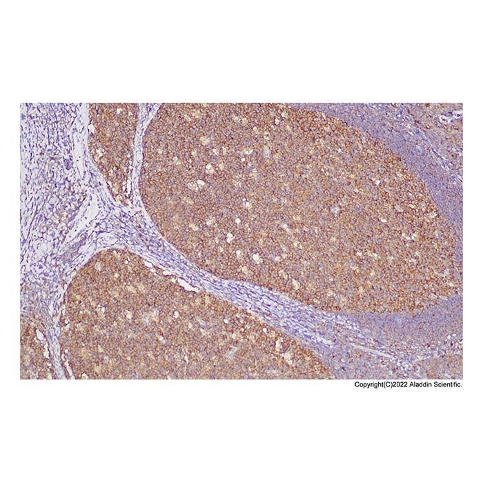 Recombinant NM23A Antibody - by Aladdin Scientific