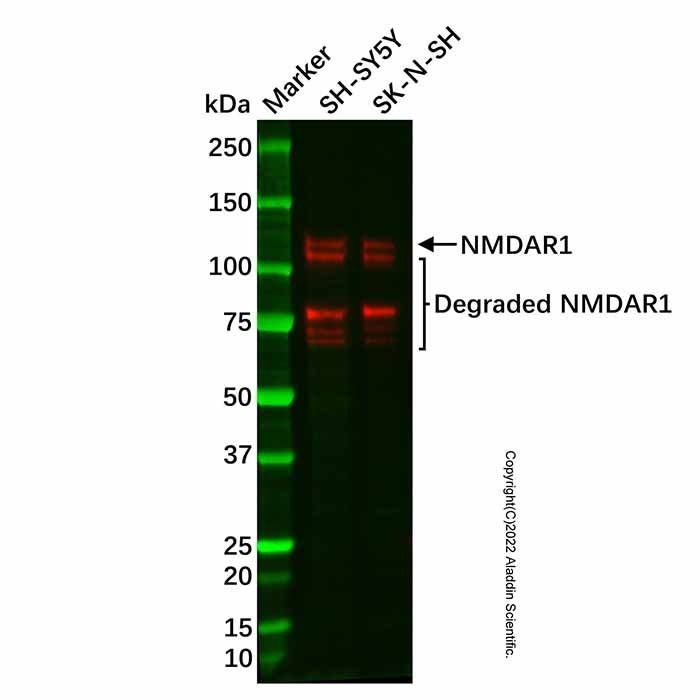Recombinant NMDAR1 Antibody -    by Aladdin Scientific