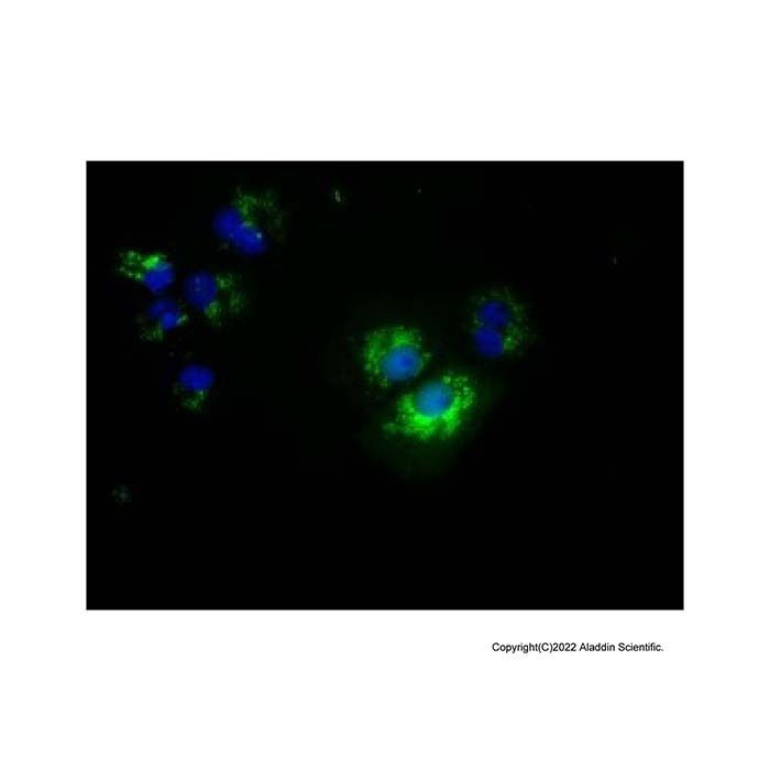 NME4 Mouse mAb - by Aladdin Scientific
