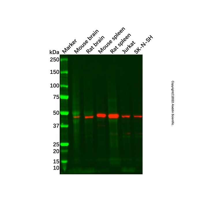 Recombinant NR2E1/Tailless/TLX Antibody -    by Aladdin Scientific