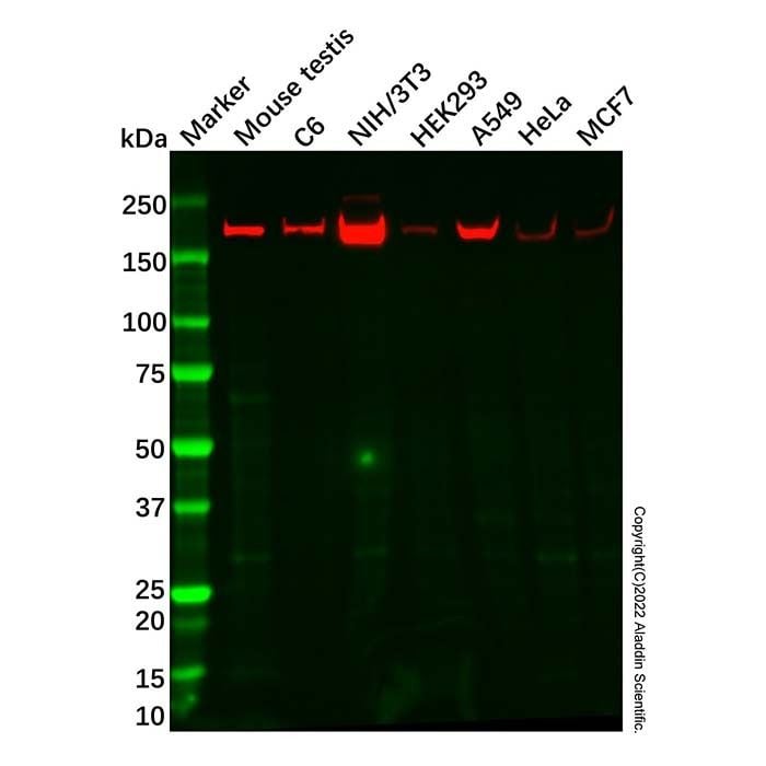 Recombinant NSD3 Antibody -    by Aladdin Scientific