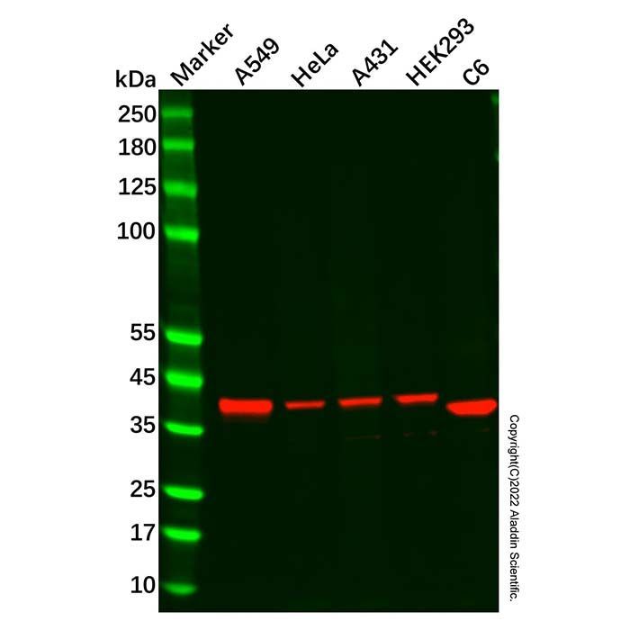 Recombinant NSDHL Antibody -    by Aladdin Scientific