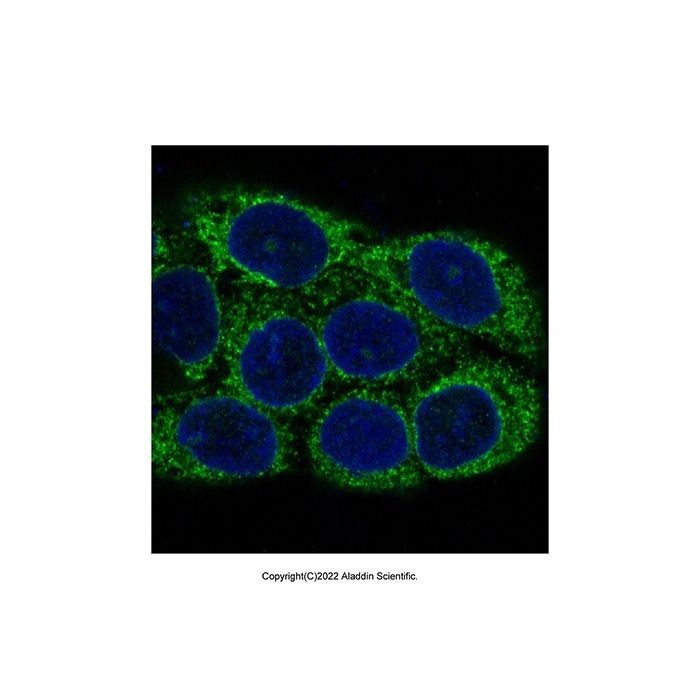 Recombinant NSE Antibody -    by Aladdin Scientific