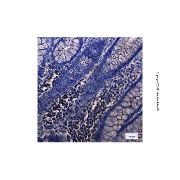 Recombinant NUDT19 Antibody -    by Aladdin Scientific