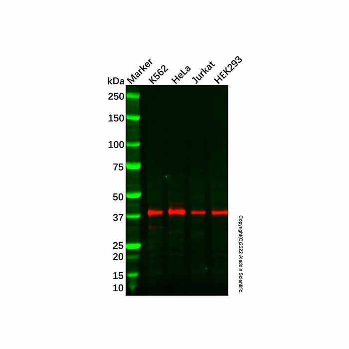 Recombinant NUDT9 Antibody -    by Aladdin Scientific