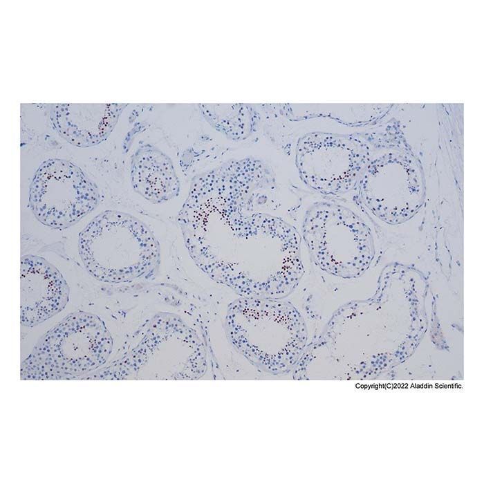 Recombinant NUT Antibody -    by Aladdin Scientific