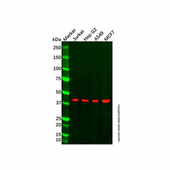 OBFC1 Mouse mAb - by Aladdin Scientific