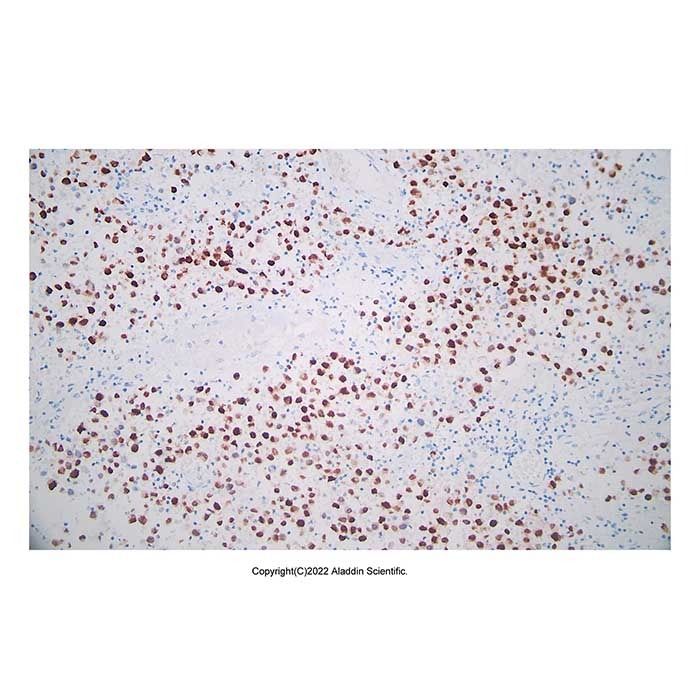 Recombinant Oct4 Antibody -    by Aladdin Scientific