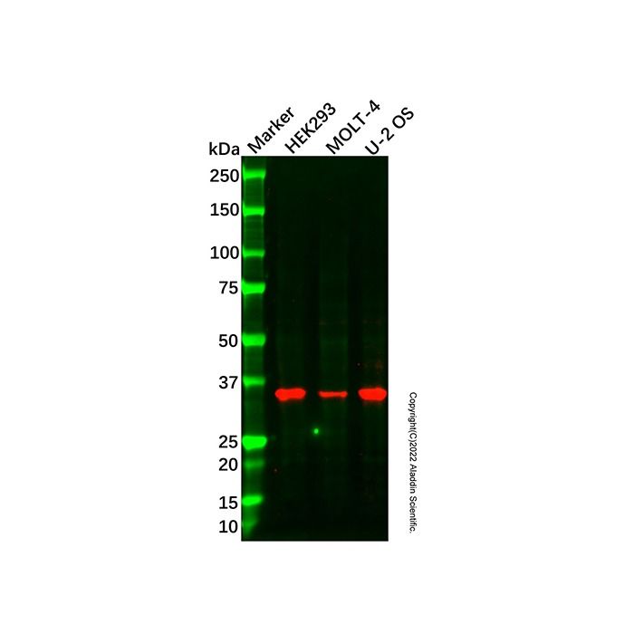 Recombinant Olig1 Antibody -    by Aladdin Scientific