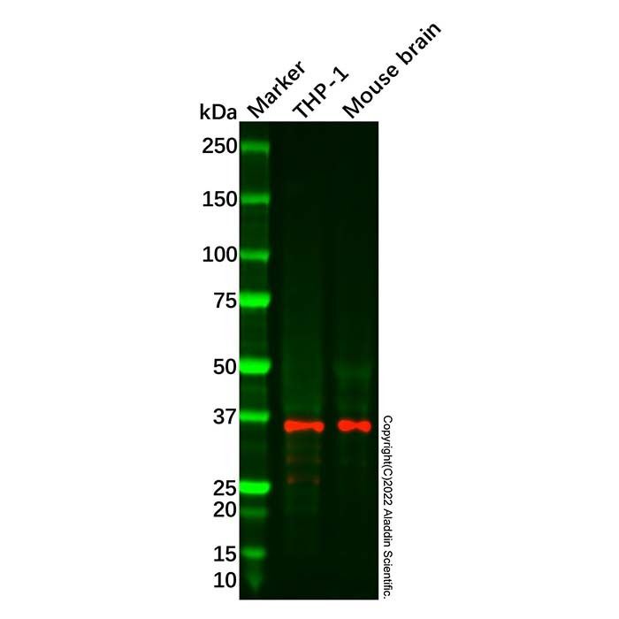 Recombinant Olig2 Antibody -    by Aladdin Scientific