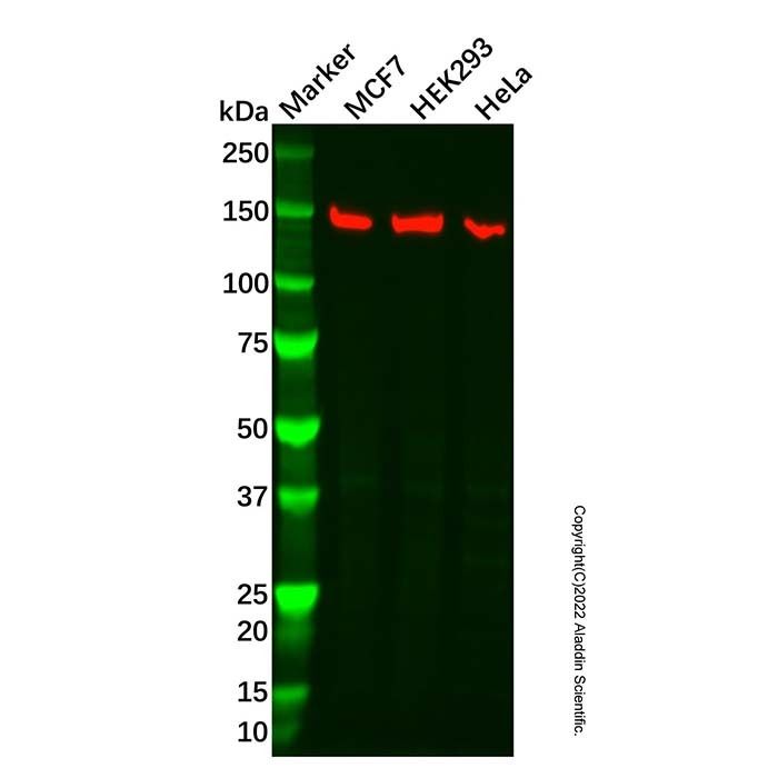 Recombinant ORP150 Antibody -    by Aladdin Scientific
