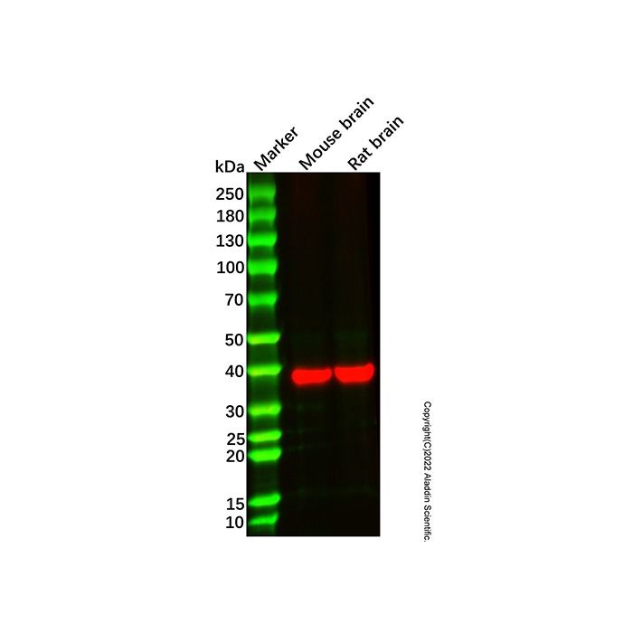 Recombinant Otx1 Antibody -    by Aladdin Scientific