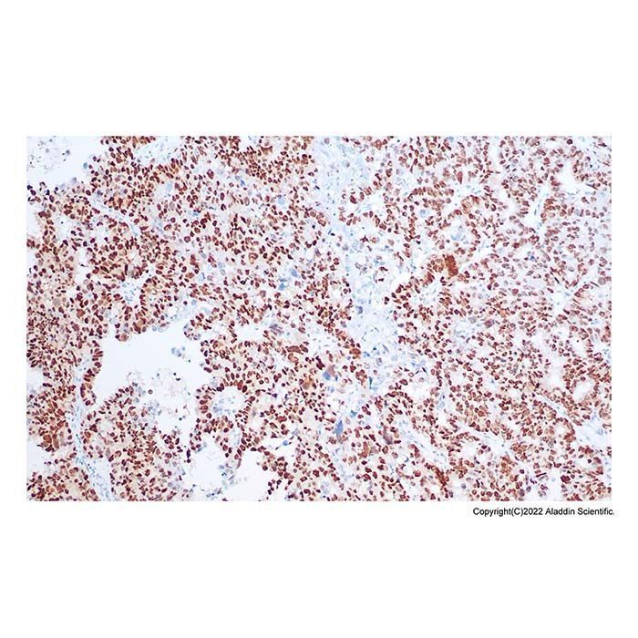 Recombinant p53 Antibody -    by Aladdin Scientific