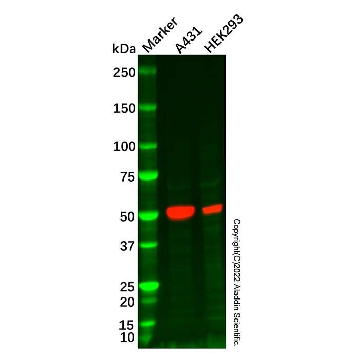 Recombinant p53 Antibody -    by Aladdin Scientific