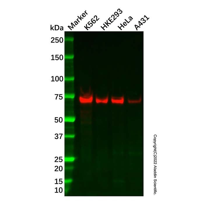 Recombinant p60 CAF1/MPP7 Antibody -    by Aladdin Scientific