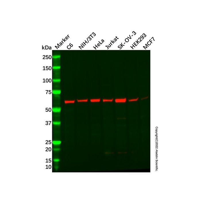 Recombinant PAK1 Antibody -    by Aladdin Scientific