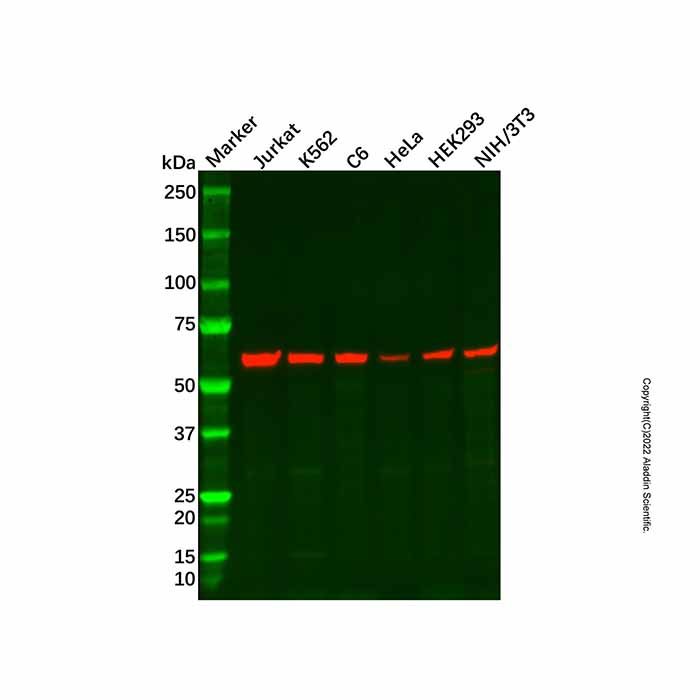 Recombinant PAK2 Antibody -    by Aladdin Scientific