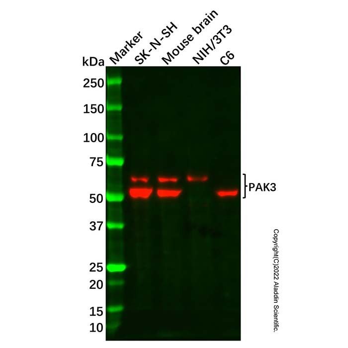 Recombinant PAK3 Antibody -    by Aladdin Scientific