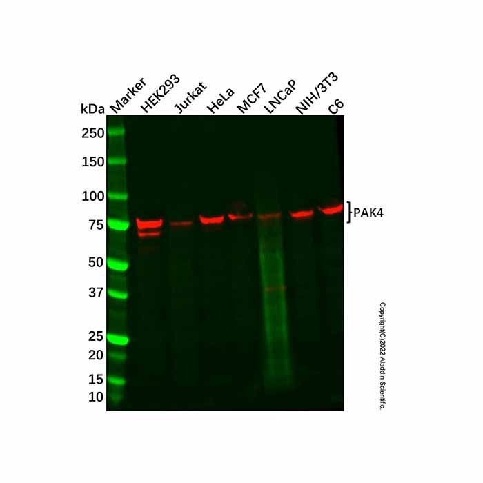 PAK4 Mouse mAb -    by Aladdin Scientific