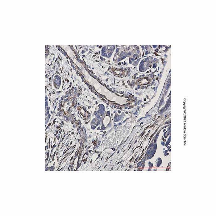 Recombinant pan Cadherin Antibody -    by Aladdin Scientific