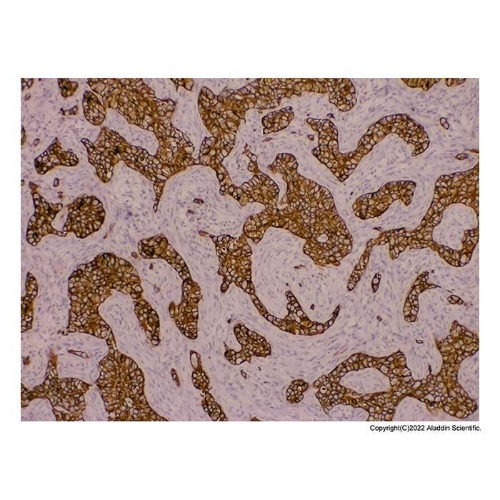 Recombinant pan Cytokeratin Antibody -    by Aladdin Scientific