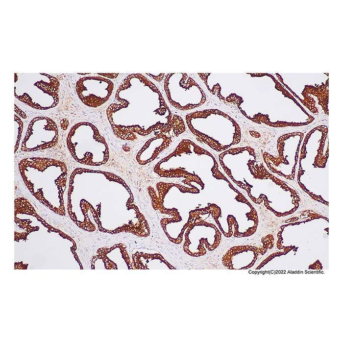 Recombinant PAP Antibody -    by Aladdin Scientific