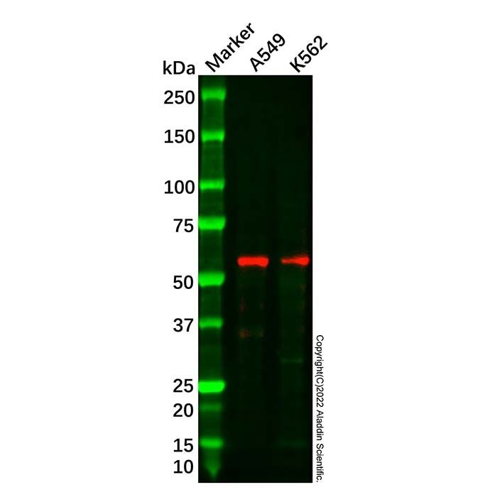 Recombinant PAR2 Antibody -    by Aladdin Scientific