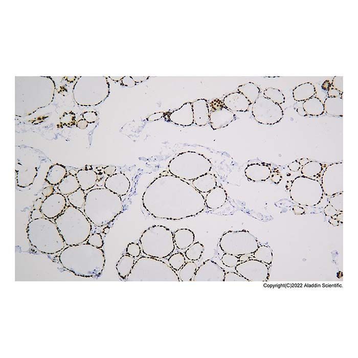 Recombinant PAX8 Antibody -    by Aladdin Scientific