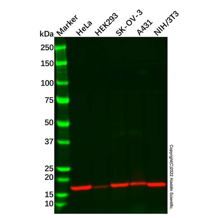 Recombinant PBR Antibody -    by Aladdin Scientific