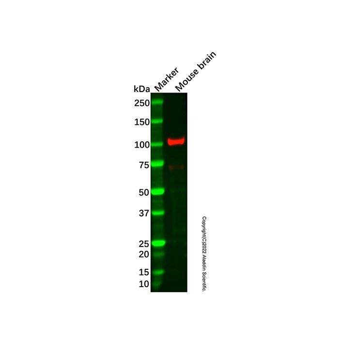 Recombinant PDE2A Antibody -    by Aladdin Scientific
