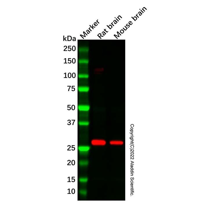 Recombinant PDGF B Antibody -    by Aladdin Scientific