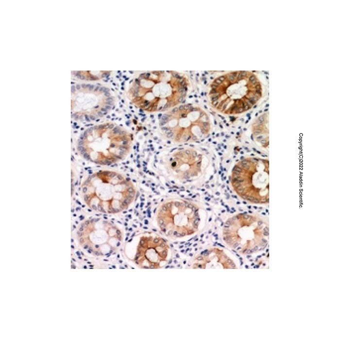 PDGFC Antibody -    by Aladdin Scientific