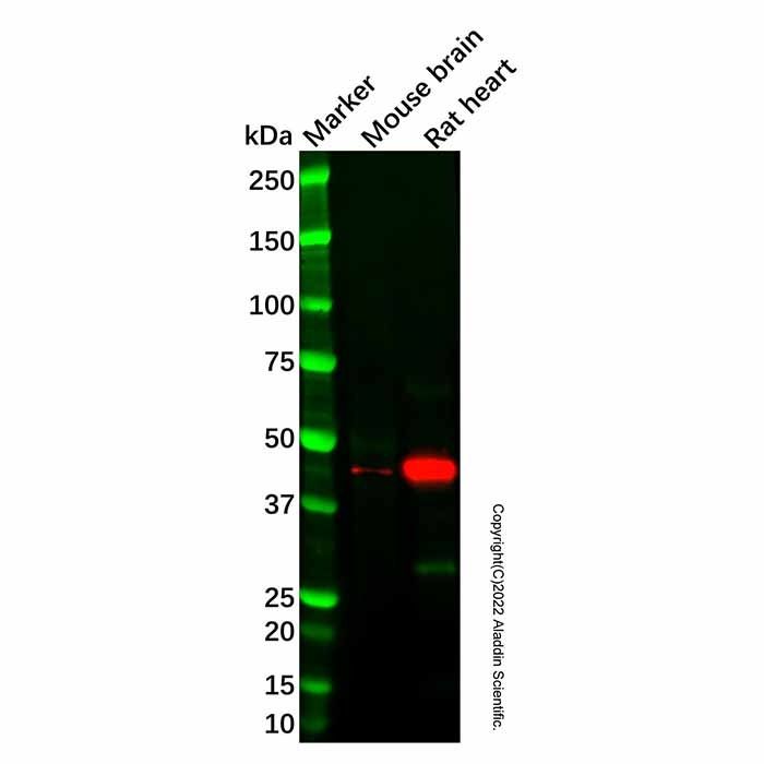PDK2 Antibody -    by Aladdin Scientific