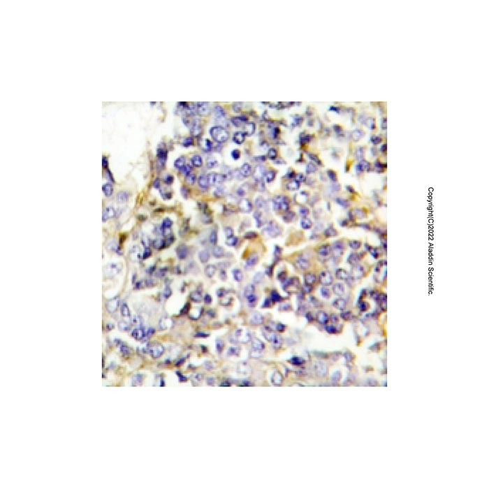 Pentraxin 3/PTX3 Antibody -    by Aladdin Scientific