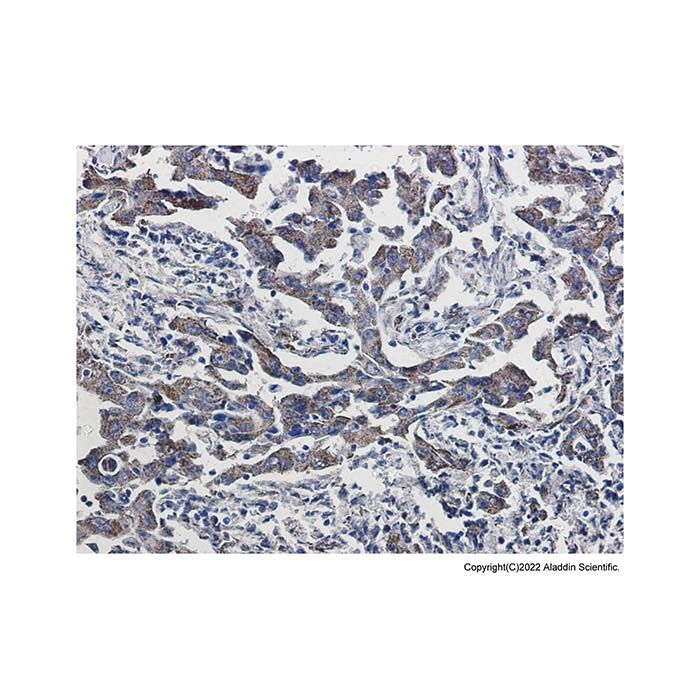 Recombinant Peroxiredoxin 5 Antibody -    by Aladdin Scientific