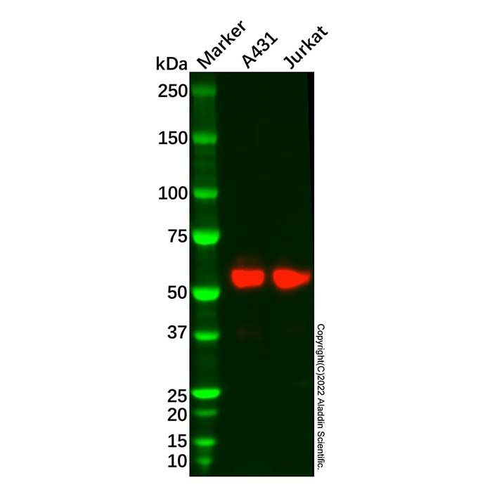 Recombinant PFKFB3 Antibody -    by Aladdin Scientific