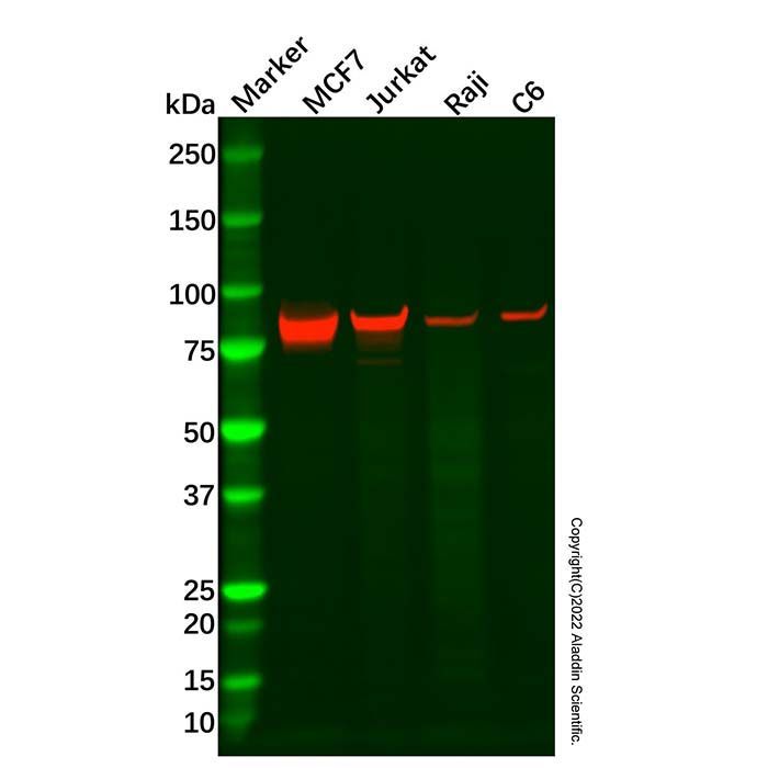 Recombinant PFKP Antibody -    by Aladdin Scientific